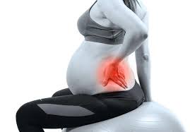 back pain after pregnancy