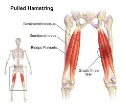 hamstring strains causes rehab and