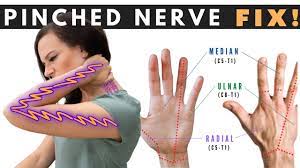 how to fix a pinched nerve in the neck