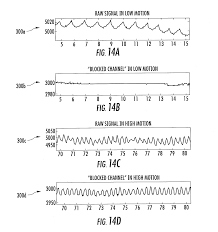 Us20140171762a1 Wearable Light Guiding Bands And Patches