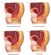 con abnormalities of the pelvic