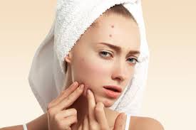 how to get rid of acne scabs when you