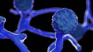 Hongo negro | un desafío mayor que el coronavirus: Mucormicosis El Peligroso Hongo Negro Que Afecta A Pacientes De Covid 19 En India Bbc News Mundo