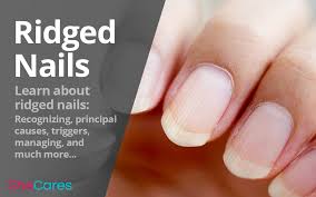 ridge nails shecares
