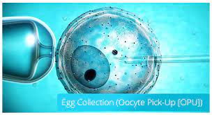 egg collection opu istanbul ivf