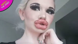 woman with biggest lips in world