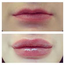 thin lips clearskin