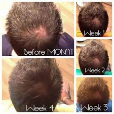 We are asked a lot how to use cbd oil for hair loss, and the process is much easier than you think. Hempworx Hair Care Hemp Haircare Organic Hemp Seed Oil For Hair Monat Hair Monat Hair Care Help Hair Loss
