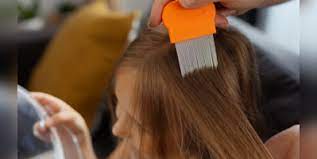 3 indian home remes to remove lice