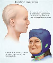 hair loss alopecia jama oncology