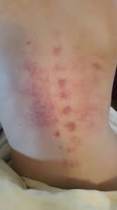 take 5 year old to doctor for this rash