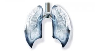 lung cancer tailoring radiation