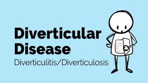 Diverticular Disease Gastrointestinal Society