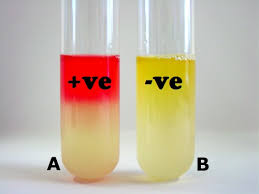 Methyl Red Test Principle Procedure And Interpretation