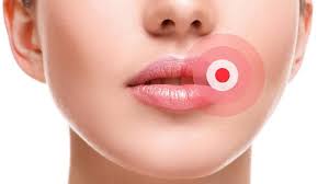 the main causes of lip numbness the