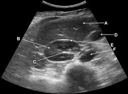 The human abdomen is divided into quadrants and regions by anatomists and physicians for the purposes of study, diagnosis, and treatment. Ultrasound Scan Of The Right Upper Quadrant Of The Abdomen Transverse Plane The Bmj