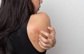 stds that cause dry skin a complete guide