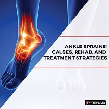 early ankle sprain rehab and exercises