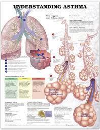 Understanding Asthma Chart Poster Laminated Asthma