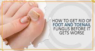 foot and toenail fungus