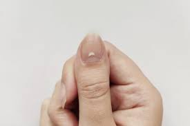 Check spelling or type a new query. Here S What It Means If You Have White Spots On Your Nails The Healthy
