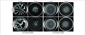 study of cell motility of p aeruginosa