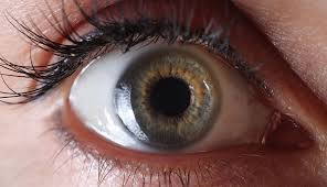retinal detachment 3 most common