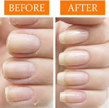 nail tek nail recovery kit cuticle oil