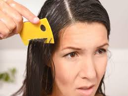 remes to get rid of head lice