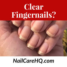 clear fingernails is it a bad thing