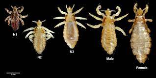 body lice what does body lice look