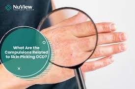 skin picking ocd signs symptoms