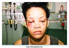 Not only chris brown tattoo rihanna, you could also find another pics such as chris brown beats rihanna, chris brown with rihanna, chris brown vs. Chris Brown Tattoo Of Rihanna Beat Up 3 Mr Steve And His Fascinating Photos Flickr