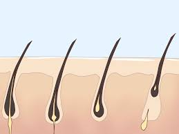 6 ways to get rid of body hair wikihow