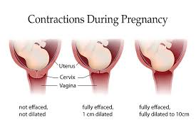 3 Types Of Contractions During Pregnancy Its Significance