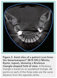 dental cone beam ct imaging