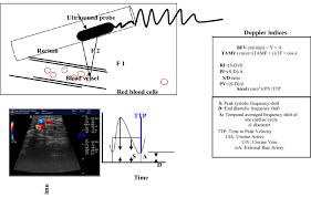 Manipulation And Orientation Of Doppler Ultrasound Probe And