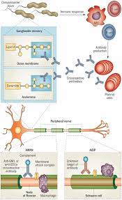 acute motor axonal neuropathy caused by