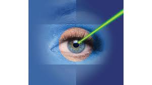 laser eye surgery cost understanding