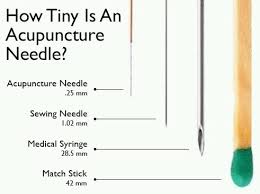 What To Expect Embrace Acupuncture