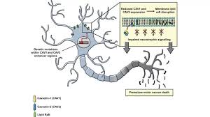 motor neuron disease mnd