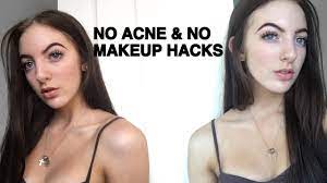 how i got rid of my acne how to look
