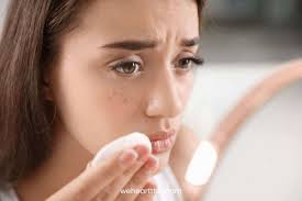 how to safely remove eyelash extensions