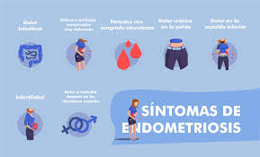 Los sintomas de la endometriosis incluyen carencia de síntomas, dolor intestinal, dolor de esta página intenta proporcionar una lista con información de algunos de los posibles síntomas de la. Endometriosis Los Sintomas Que La Delatan Blog Ingenes