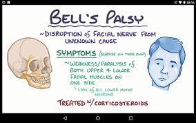 palsy osmosis flashcards quizlet