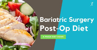 bariatric surgery post op t guide