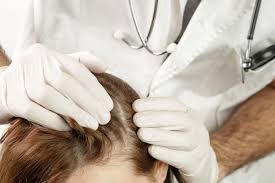 scalp infections causes symptoms and