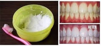 natural teeth whitening