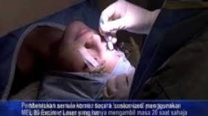 Ophthalmology contents (continued) (continued) robert b. Prof Dr Muhaya Dynas Mokhtar Lasik Part02 Bm Youtube