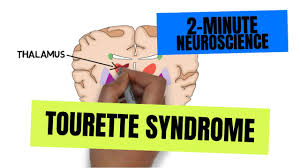 neuroscience tourette syndrome